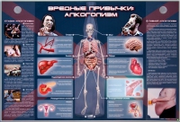 Электрифицированный стенд "Вредные привычки: алкоголизм" - «globural.ru» - Тюмень