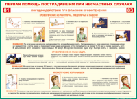Таблица Порядок действий при опасном кровотечении 1000*1400 винил - «globural.ru» - Тюмень